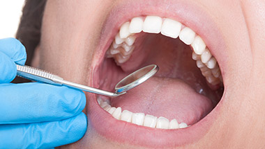 Closeup of flawless healthy teeth