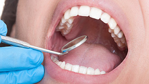 Smile examined after dental crown placement