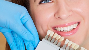 Closeup of teeth compared to color shading chart