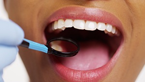 Closeup of patient's smile during examination