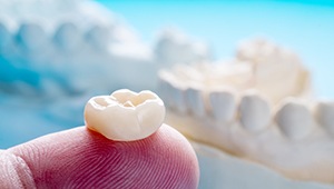 Dental crown resting on a fingertip