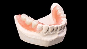 Model of smile with partial denture