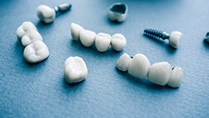 Different types of dental implants in Phoenix on blue background
