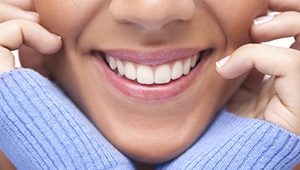 Closeup of perfect smile after makeover