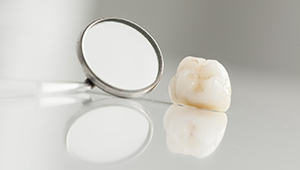 Dental crown restoration on table top