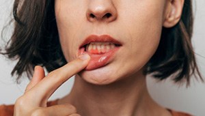 Lady shows inflamed gums