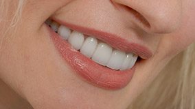 Closeup of healthy smile