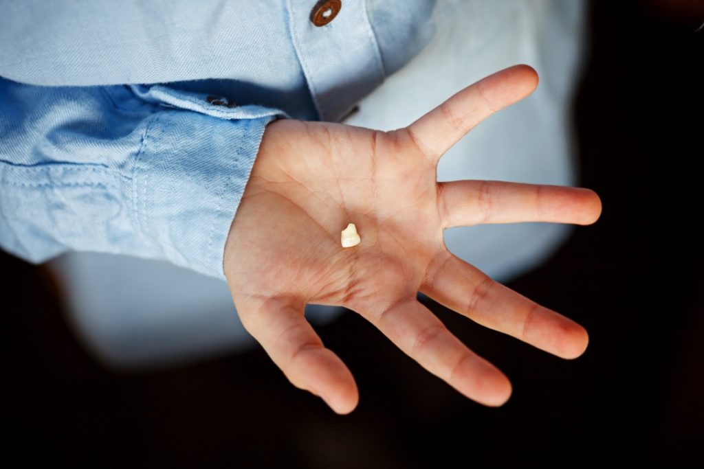 Someone holding a knocked-out tooth at the dentist