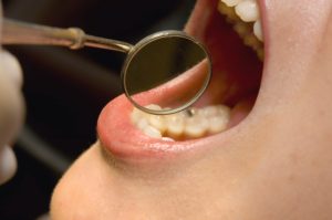 dentist in phoenix