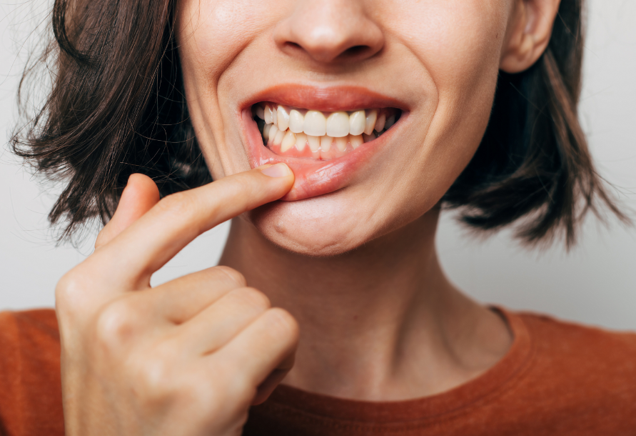 Woman showing gums